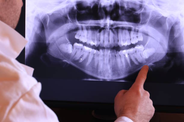 Best Dentist for Severe Toothache  in Marthasville, MO
